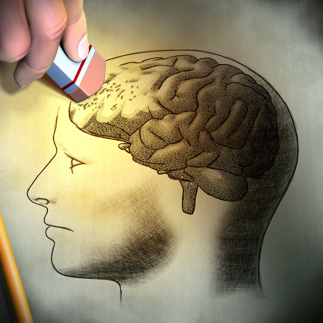 other-types-of-memory-loss-alzheimer-s-los-angeles